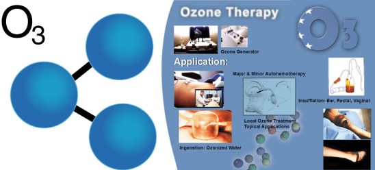 Ozone